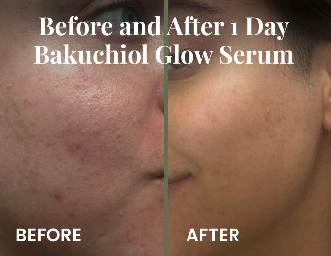 Eucalyptus Tea Tree • Déodorant naturel - Results