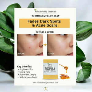 Savon au curcuma et au miel | Atténue l'hyperpigmentation, les cicatrices d'acné et plus encore