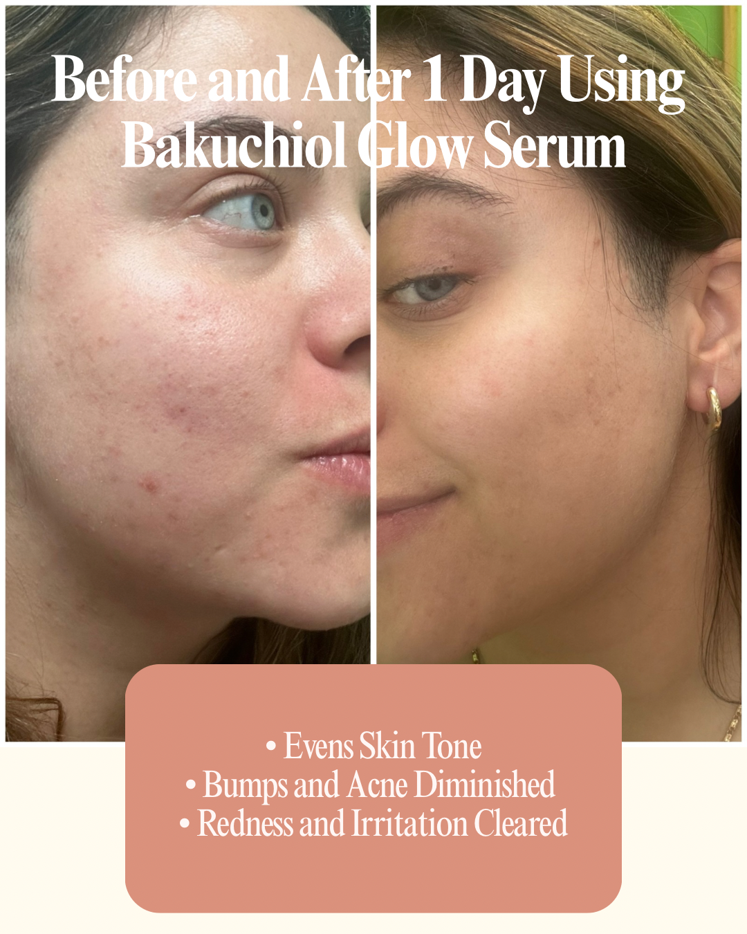 Bakuchiol Glow Serum✨