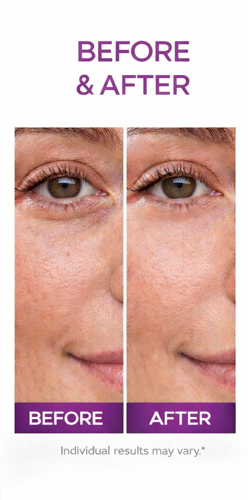 Bakuchiol Under Eye Serum | Brighten + De-Puff + Smooth