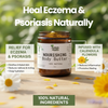 Nourishing Body Butter | Eczema & Psoriasis Relief