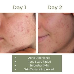 Turmeric & Honey Soap | Natural Brightening & Cleansing Bar